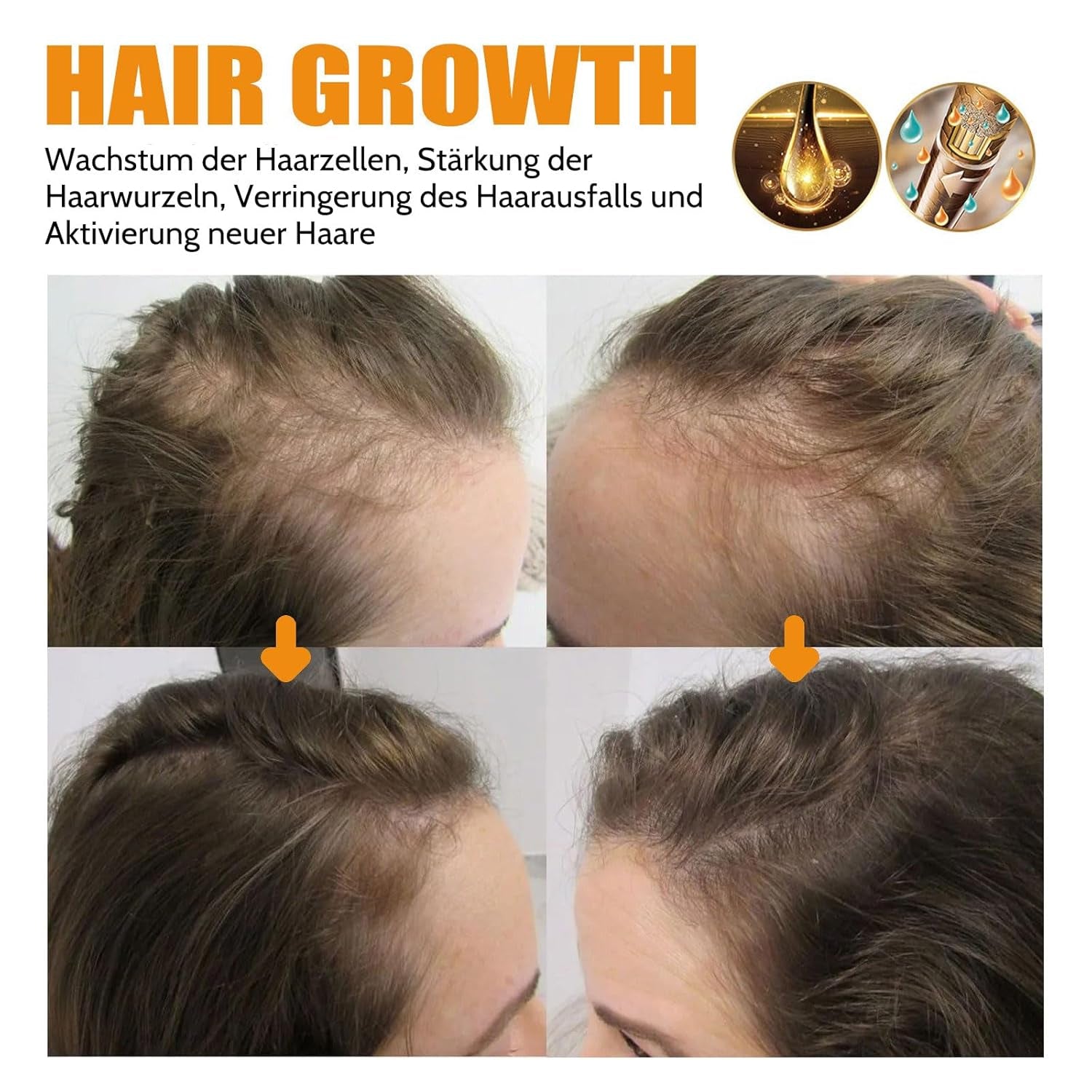 Biotin Hair Serum, 2PCS Hair Spray Hair Growth Accelerate Hair Growth Serum Biotin Hair Growth Hair Growth Spray, Hair Care for Thin Dry Hair, Against Hair Loss (M-2pcs) Ingrijirea parului Naty Shop