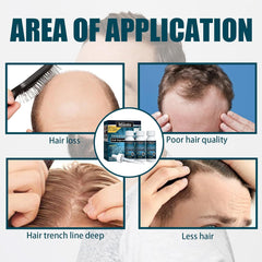 Miioto ser de creștere a părului, produs de creștere a părului pentru bărbați, ser de păr pentru creșterea părului, îngrijirea scalpului promovează părul mai gros hrănește scalpul și previne căderea părului, 3 * 60 ML Ingrijirea parului Naty Shop