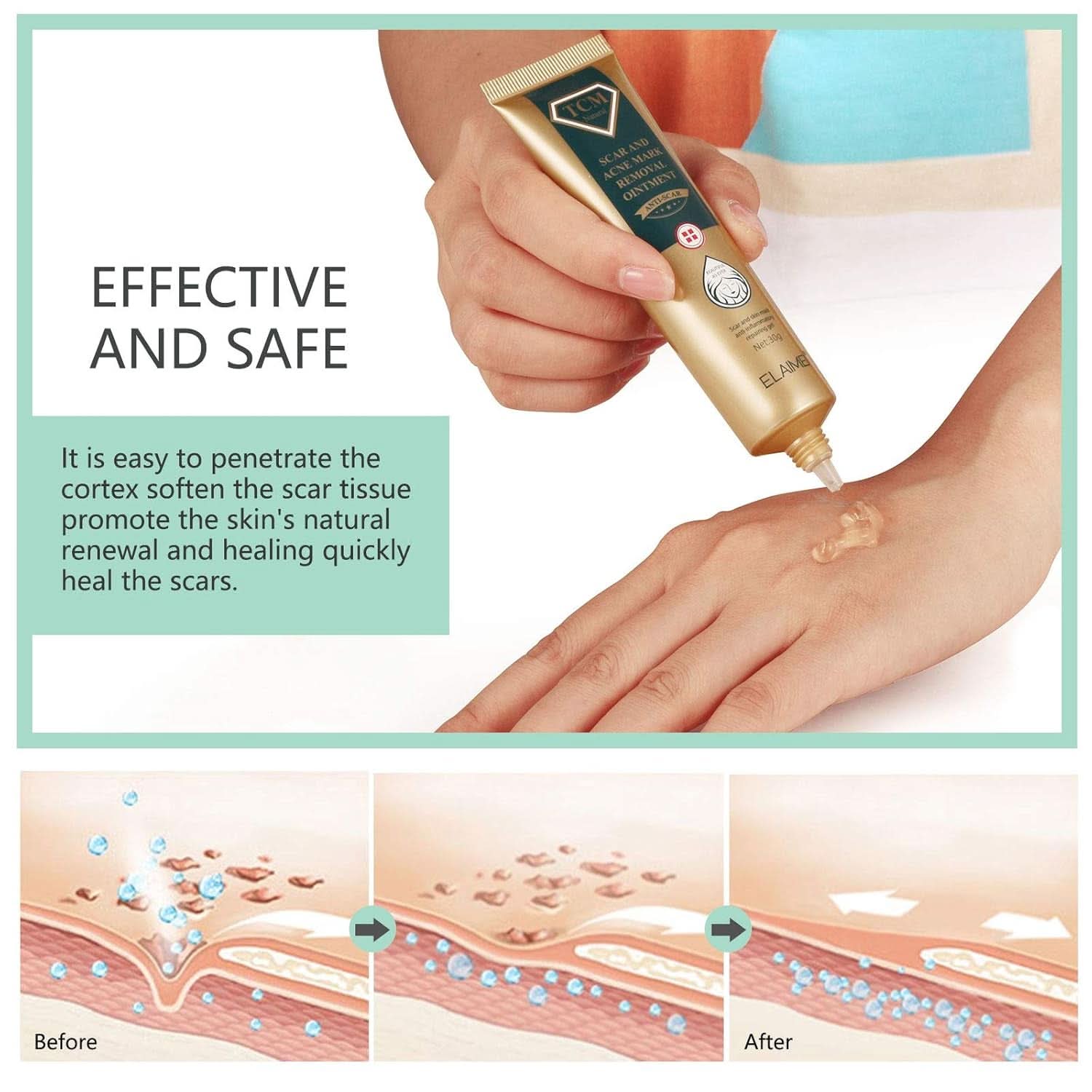 Gel gegen Narben, 30g Kosmetik und Schönheit Naty Shop