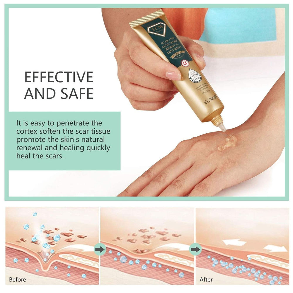 Gel gegen Narben, 30g Kosmetik und Schönheit Naty Shop