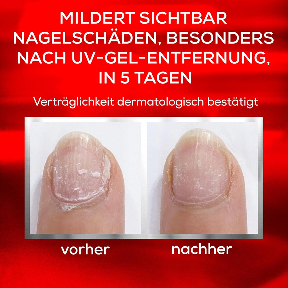 Essie Nail Rescue Kit: Nagel- und Nagelhautöl mit Aprikosenduft + To the Rescue Repair Nagellack